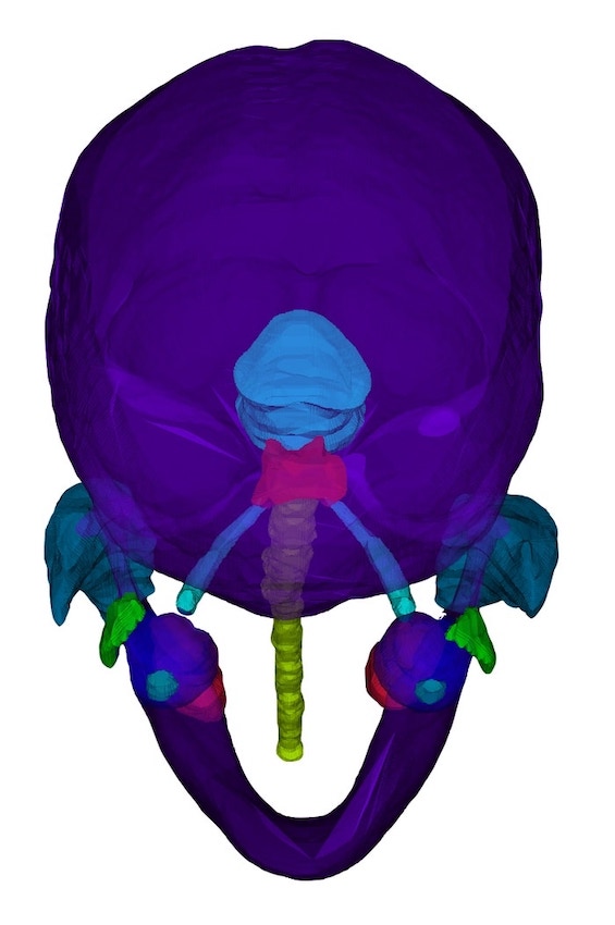 3D Head Neck Segmentation